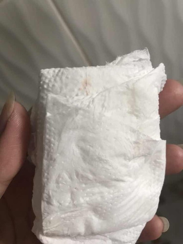 ตั้งครรภ์ได้ 37 สัปดาห์ มีเลือดออกนิดๆ