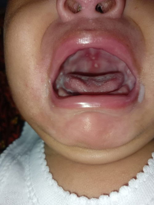 Di langit* bayi ada putih*...