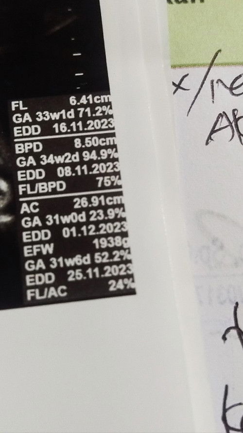 Masya Allaah tabarokallaah