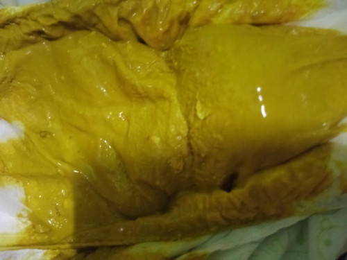 สอบถามเเม่ๆค่ะ น้องกินนมผงล้วน อึเป็นน้ำเหลวมีเม็ดแบบนี้ปกติไหมค่ะ