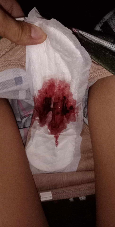 1week pong lumalabas then ganito na.po siya ngayon 🥺 pls pasagot po. 8weeks pregnant po