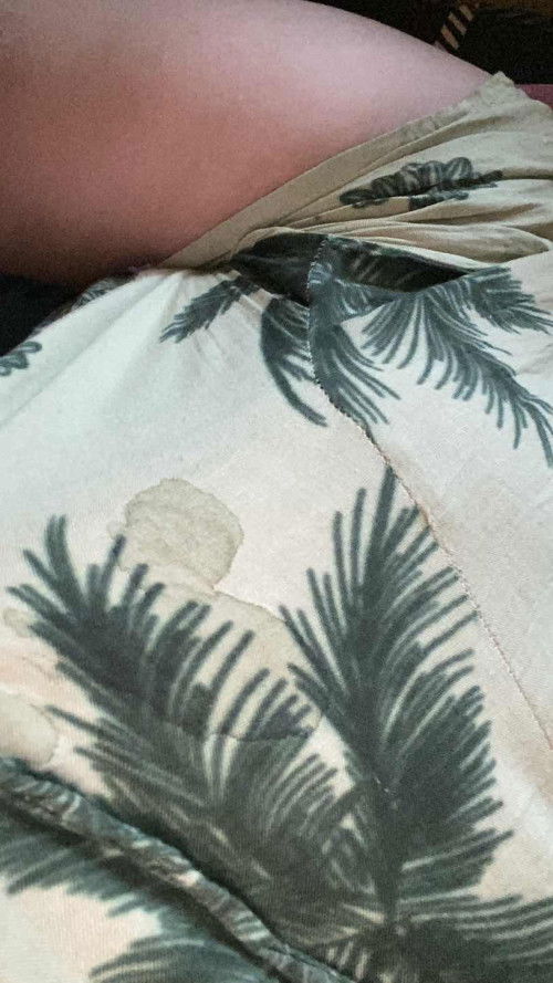 ASI rembes di usia 28w