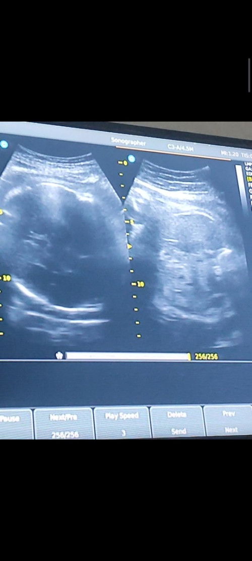 KEHAMILAN 40week 1day