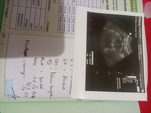 Hamil 8 minggu USG blm terlihat janin