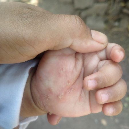 Ada yang tau obat buat gatal"?