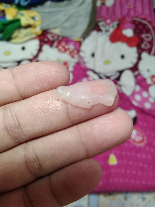 มีมูกแบบนี้ออกควรไปโรงบาลมั้ยค่ะ