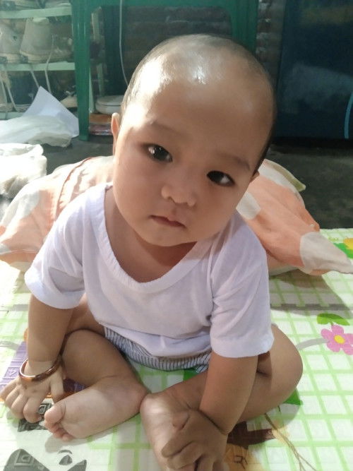 kepala miring ke kiri