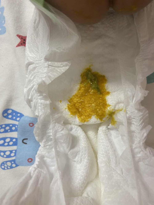 Đi ngoài phân xanh