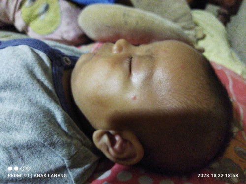 Sharing donk bun debay pipinya kok kyk gtu ya awalnya itu kyk bruntusan mrh lma2 kyk panu bun🙏🙏