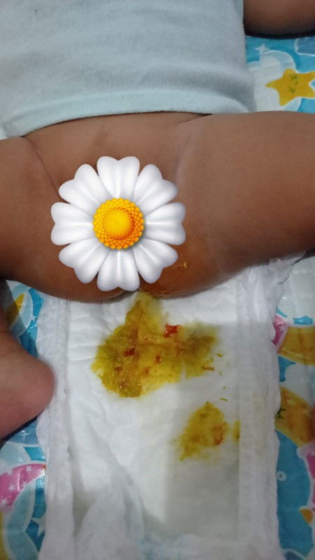 Bayi usia 2bulan 20hari berdarah ya Allah😭