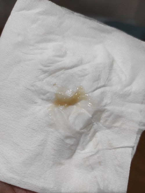 Bahaya kah keluar lendir seperti ini ? Usia kehamilan 6 bulan