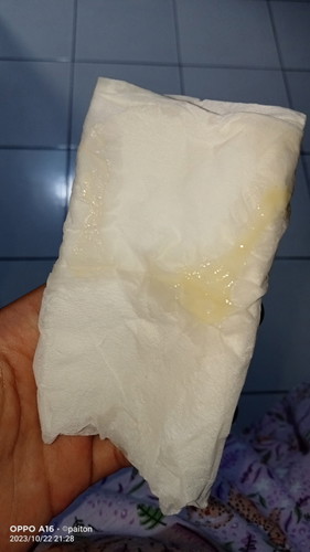 Perut sering kenceng" nyeri punggung nyeri kyk haid trs kluar kputihan kyk gitu tp blm ada flek