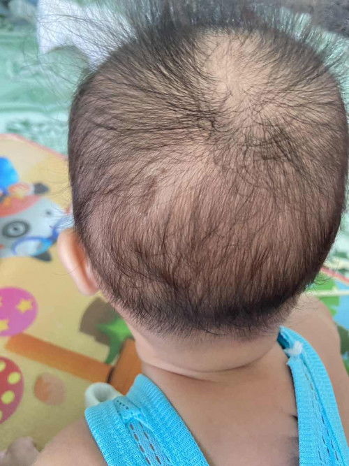 มันคืออะไรคะ รักษาอย่างไรดี?