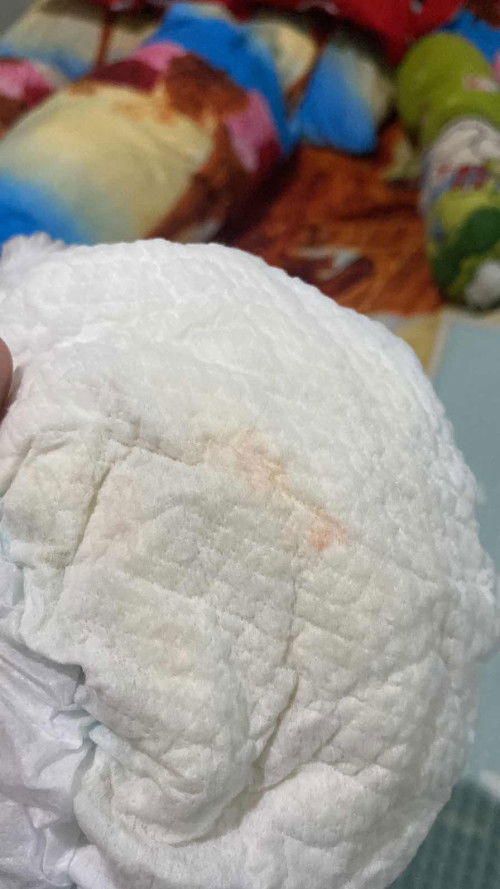 Ada bercak merah ke orange an di pampers bayi laki2 di umur 3bulanan