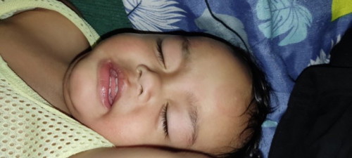 Bakit po puro pula katawan ng baby kopo chaka nung lumabas po yun nilalagnat po sya kapag gabe.