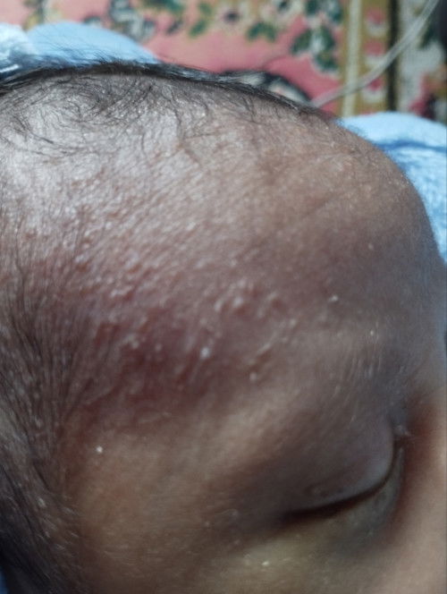 Bun ini kenapa ya? Anakku baru usia 2minggu