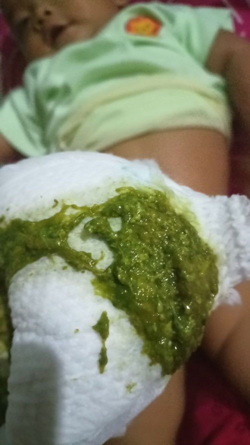 Bab warna hijau kondisi demam dan bapil kalau ke dokter anak keuangan tidak sanggup