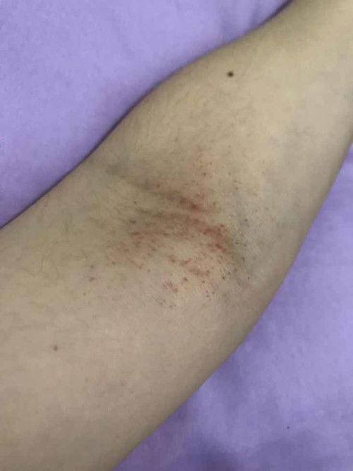 Hello mga mi, baka may nakakaalam or may same cases po kagaya nito