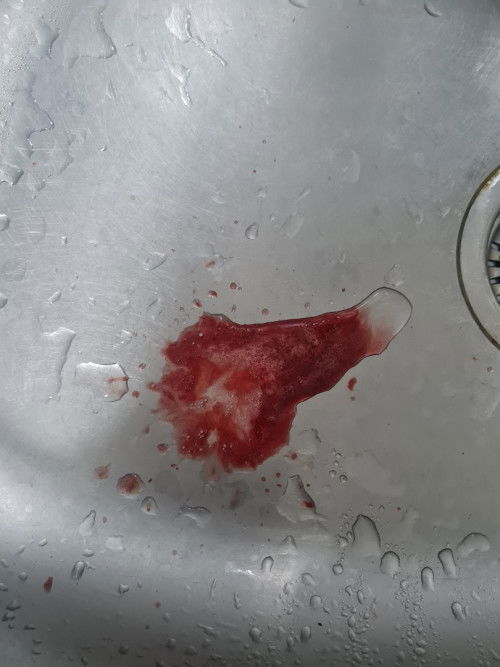 ใครเป็บบ้างคะ​ เลือดออกปาก​ ตามไรฟัน