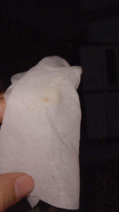 Flek setitik auto panik