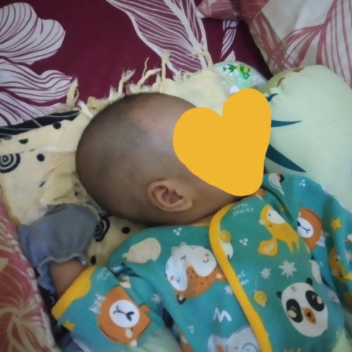 Kepala bayi