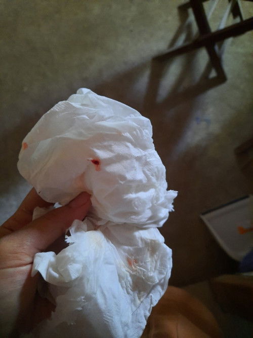 Keluar darah saat 8 week