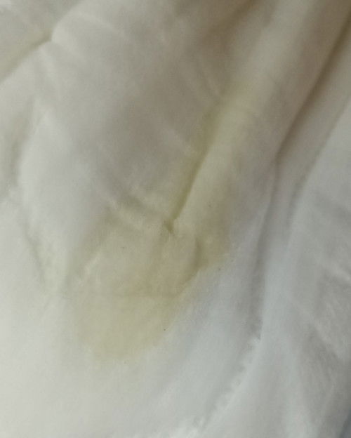 keputihan di hamil 23 minggu