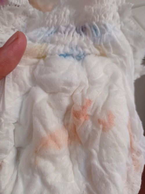 Bayi umur 6bln di pampers ada bercak orange, itu kenapa ya?