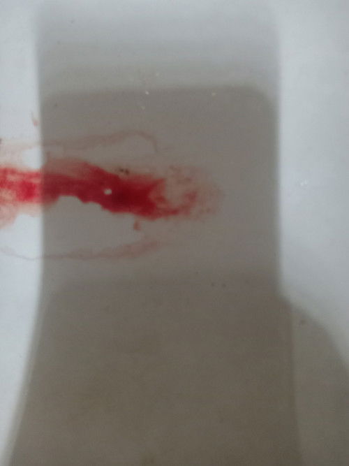 Spotting, 2nd trimester