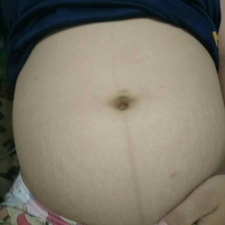 31w เพศลูก