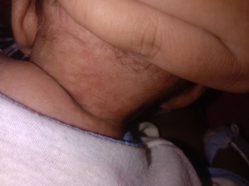 Anu po ba ito? Bigla nlng po ngkaroon ng ganto u g baby ko 1month old po sya