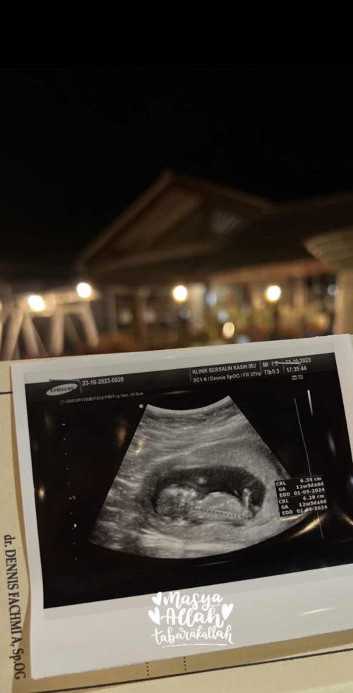 USG DI 12MINGGU 5HARI