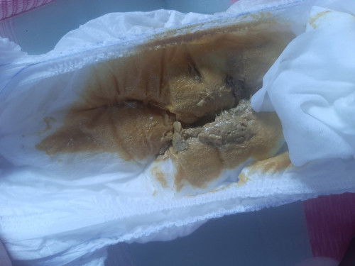 Najis Bayi susu badan campur formula