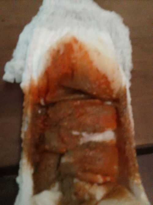 สีอึลูก ต้องไปหาหมอไหมค่ะ