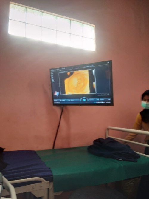 Merasa bingung soalnya hamil pertama