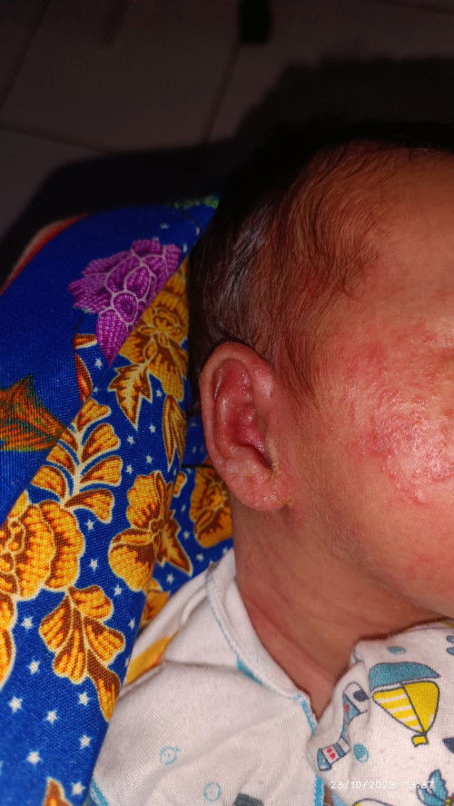 Kuping anak ber air dan berkerak kuning kenapa ya bund?