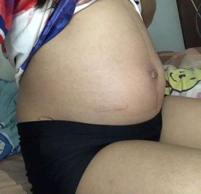 30+3 ท้องเล็กมากๆๆๆๆ