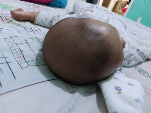 Kepala bayi peyang