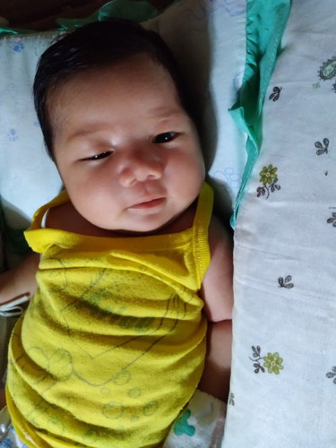Congenital ptosis?