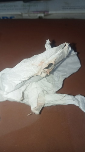 Maaf kalo kurang sopan, aku hml anak 1, keluar keputihan putih tapi iseng lap ada flek knpa ya?