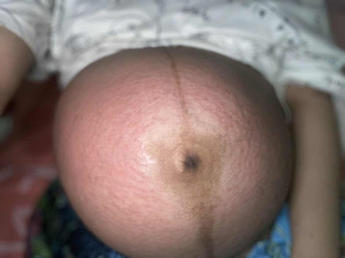 38+3week มีวิธีไหนบ้างคะ