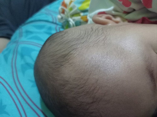 Keringat bayi