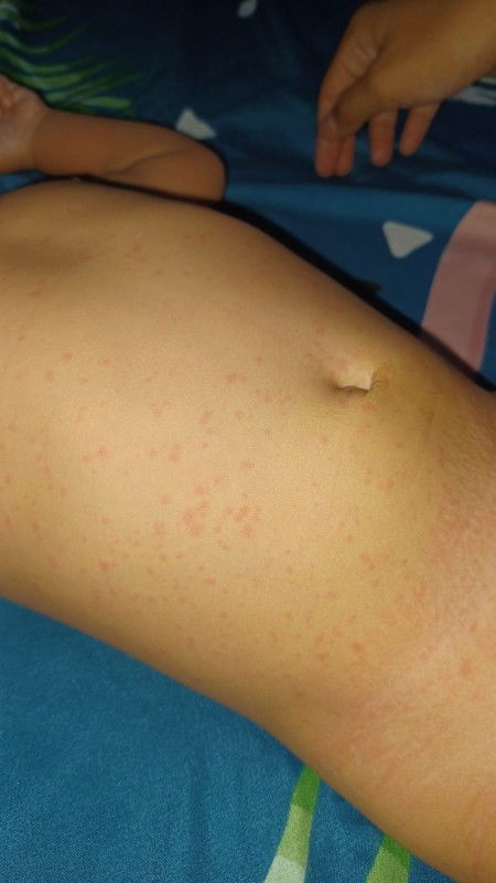 Bayi bunda ada yang pernah ngalamin ga?