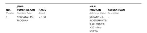 Tes SHK bayi baru lahir