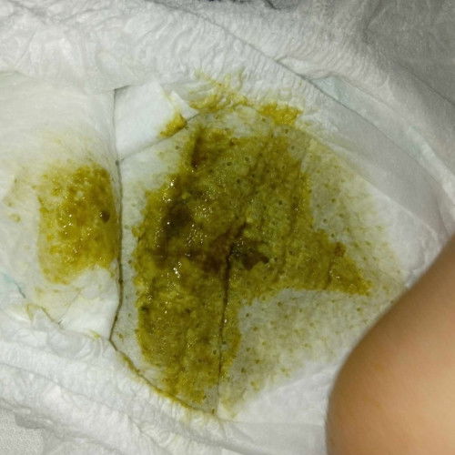 Poop ni baby pure bf