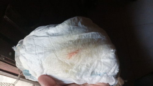 Bercak merah di pampers