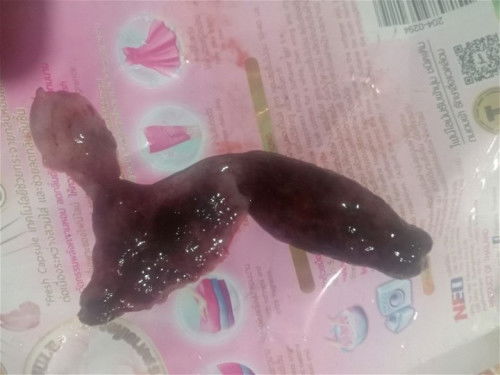 มันคือก้อนเลือดอะไรค่ะ(สรุปหมอบอกเราแท้งค่ะ หลุดออกหมดแล้ว)