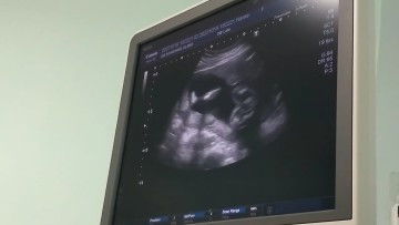 แม่ๆคะแบบนี้หญิง 100% ไหมคะ