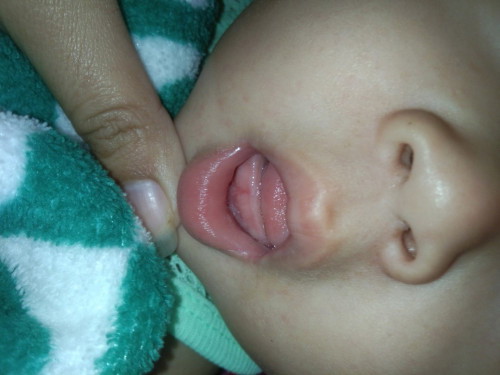 ฟันน้องจะขึ้นรึป่าว?