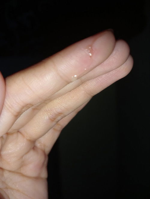 Keluar Lendir sedikit coklat